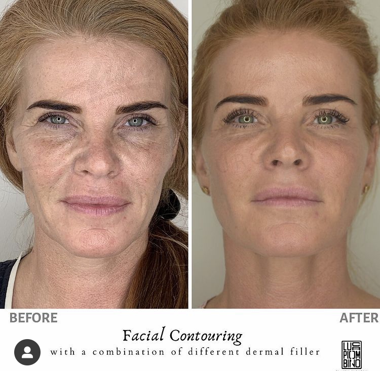 Face Contouring