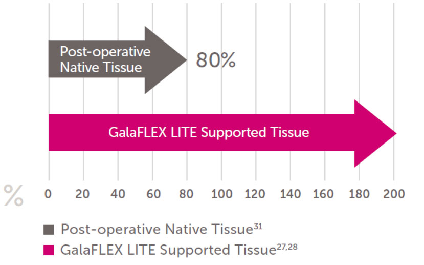 Galaflex