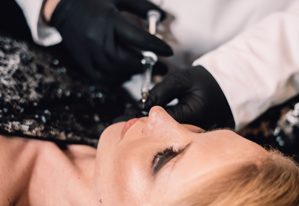 filler e medicina estetica 